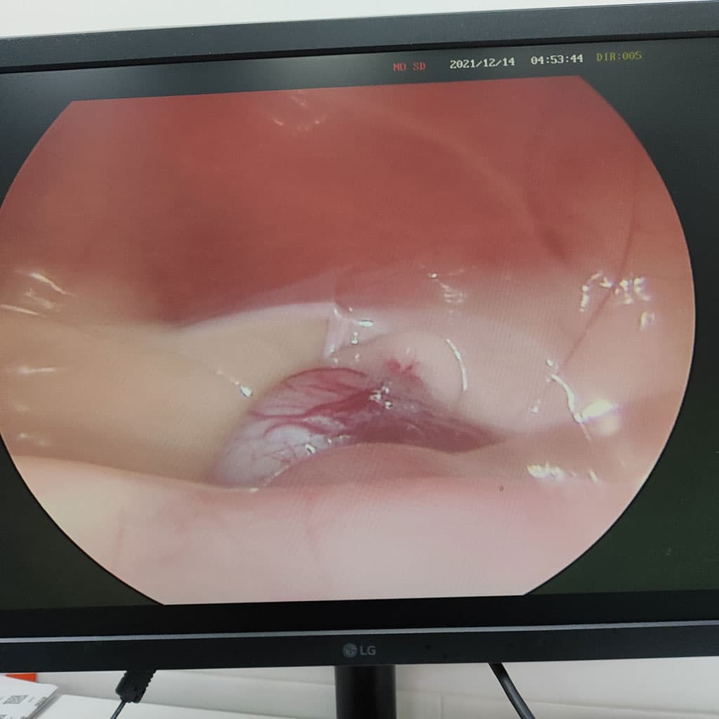 Cirugías menos invasivas para una mejor recuperación